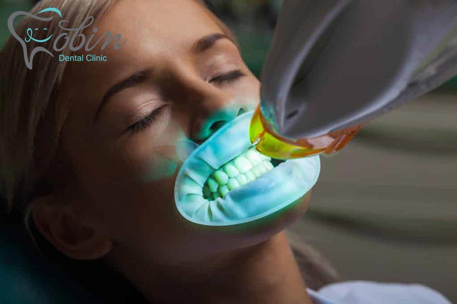 دوره ی مراقبت های بعد از بلیچینگ دندان